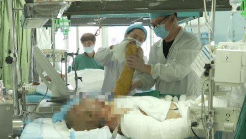如皋医院爆料烧伤视频,惨烈现场令人揪心 第3张 如皋医院爆料烧伤视频,惨烈现场令人揪心 第3张
